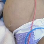 9 Month-Old Baby Boy Krithagya Suffering Cancerous Tumour Needs Your Help!