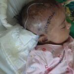 6 Month-Old Riyan Singh Suffering from brain infection for the past few months