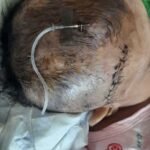 6 Month-Old Riyan Singh Suffering from brain infection for the past few months